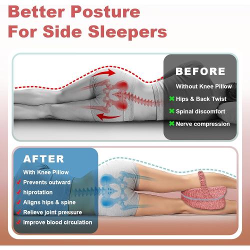 Knee Pillow for Side Sleepers, Leg Pillow for Sleeping, Knee Pillow with Strap, Alignment Pillow Between Legs, Suitable for Relieving Leg, Back & Knee Pain, Machine Washable (WHITE )