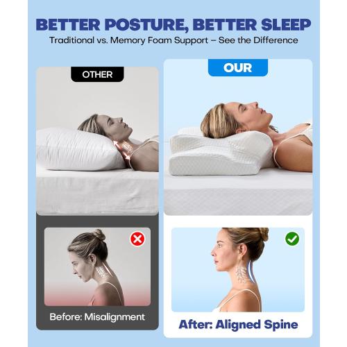 Sleep Doctor Approved Cervical Neck Pillow for Sleeping, Ergonomic Contour Side Sleeper Pillows for Adults, Cooling Orthopedic Pillow for Pain Relief Support, Memory Foam Pillows Back Stomach Sleepers