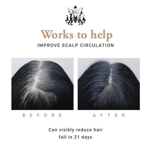 Neverfall (50ml) | Revitalizing Scalp Oil With Green Tea and Argan Oil for Hair Regrowth | Pre-Shampoo Haircare to Help Reduce Hair Loss and Promote Hair Growth for Women and Men