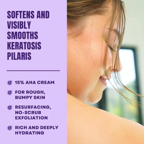 AmLactin KP Bumps Be Gone - Therapeutic Body Cream for Keratosis Pilaris - No-Scrub Exfoliator and Moisturizer with 15% Lactic Acid AHA, 3 oz (Packaging May Vary)​