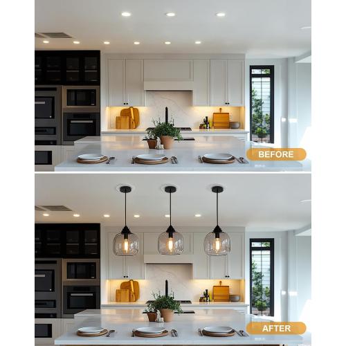 Recessed to Pendant Light Converter Kit 5 and 6 inch Can Light Conversion, Includes E26 Socket, Mounting Bracket, Round Ceiling Plate & White Cover