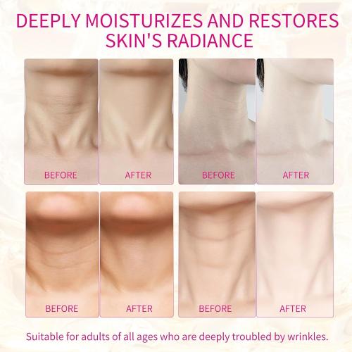 5 PCS Silicone Neck Wrinkle Patches, Reusable Overnight Anti-Wrinkle Patches, Anti Aging Silicone Wrinkle Patches for Skin Firming & Neck（2.5 Months Supply ）