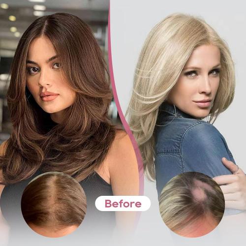 Color White REECHO Real Human Hair Topper, 10 inch Women Hair Toppers for Thinning Hair, 100 Percent Human Hair Large Coverage Natural Hairpiece Wiglet, Swiss Base 4.5x3.5, Yellow White