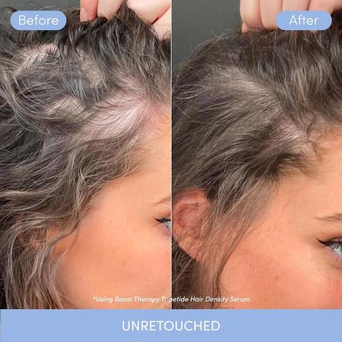 Coco & Eve Boost Therapy Tripeptide Hair Density Serum. For Thicker, Fuller Hair. Anti-Hair Loss & Shedding, Lightweight Scalp Treatment with Biotin & Caffeine for Volume & Restoration (2.03 Fl Oz)