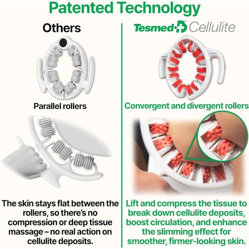 TESMED Cellulite Manual Massager Roller for Thighs and Buttocks | Made in Italy and patented, with converging and diverging roller technology for targeted anti-cellulite massage.