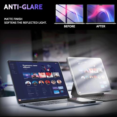 Magnetic Anti Blue Light Screen Protector for MacBook Pro 14 Inch (2021-2025, M1, M2, M3, M4, M5), Removable Glare Filter for 14.2 Mac Laptop Computer