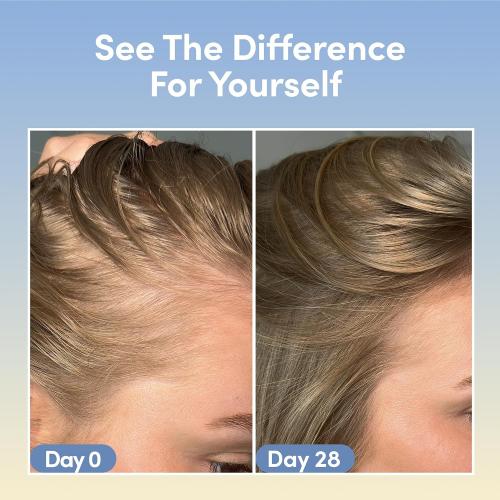 Coco & Eve Boost Therapy Tripeptide Hair Density Serum. For Thicker, Fuller Hair. Anti-Hair Loss & Shedding, Lightweight Scalp Treatment with Biotin & Caffeine for Volume & Restoration (2.03 Fl Oz)