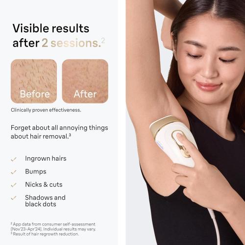 Braun Smart IPL, Silk·Expert Pro 5: at Home Laser Hair Removal for Women and Men, Permanent Visible Hair Reduction in Hair Regrowth for Body & Face, Soft Pouch and Precision Head, IPL5157