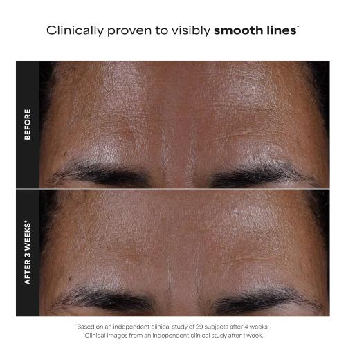 Paula's Choice SKIN PERFECTING 2% BHA Liquid Exfoliant with Salicylic Acid, Facial Polish for Pores, Wrinkles & Fine Lines, Suitable for Blackhead-Prone Skin, Fragrance-Free