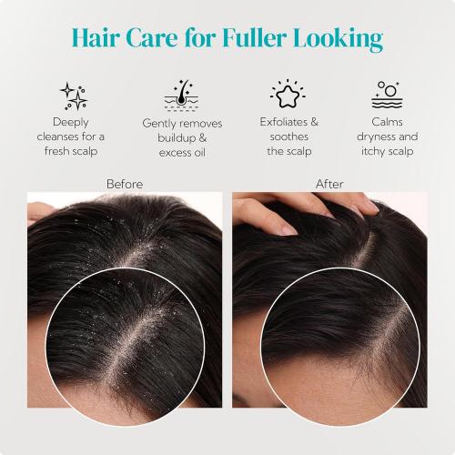 HEETA Scalp Massager 2 Pack, one item missing for Hair Growth, Soft Silicone Bristles to Remove Dandruff and Relieve Itching, Scalp Scrubber for Hair Care Relax, Shampoo Brush for Wet Dry Use, New Grey & Beige