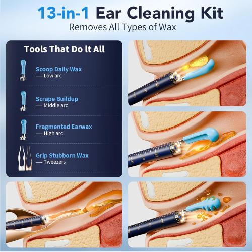 Ear Wax Removal, Ear Cleaner with Camera 1296P HD,Visual Ear Cleaner with 6 LED Lights and Flexible Tip,FSA HSA Eligible Items,Safe Ear Wax Removal Kit with Camera,Ear Cleaning Tool for Family Gifts