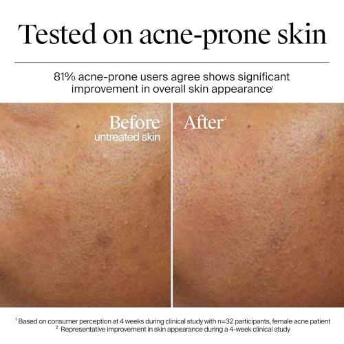 Neutrogena Hydro Boost Gel Cream, 48 Hr Hydration for Normal/Dry Skin, Fragrance Free, Face Moisturizer with Hyaluronic Acid, 1.7 oz. & Trial Size Hydro Boost Facial Cleanser, 0.5 fl oz (damage box )