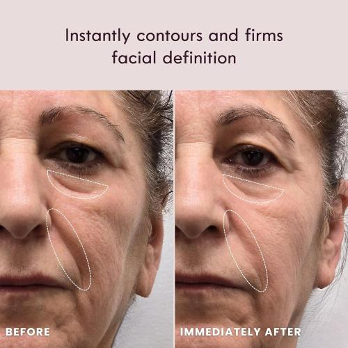 Laduora Lumeo 4-in-1 SkinLift Beauty Device   Serum Kit | Pro Glow System for Face & Neck