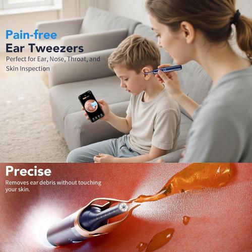 Ear Wax Removal, Ear Cleaner with Camera 1296P HD,Visual Ear Cleaner with 6 LED Lights and Flexible Tip,FSA HSA Eligible Items,Safe Ear Wax Removal Kit with Camera,Ear Cleaning Tool for Family Gifts
