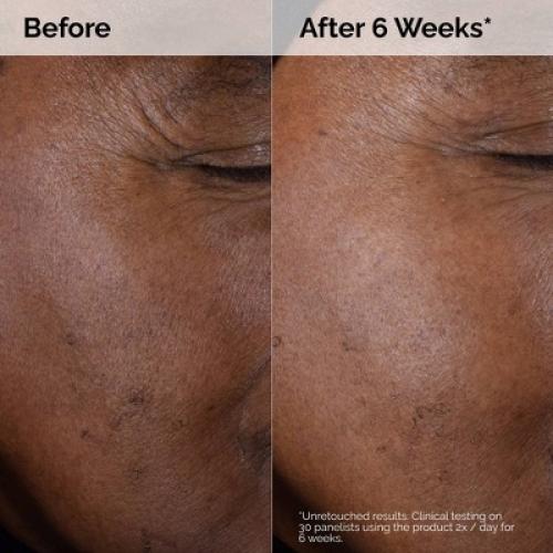 The Ordinary Glycolic Acid 7% Exfoliating and Brightening Daily Toner - 8 fl oz - Ulta Beauty