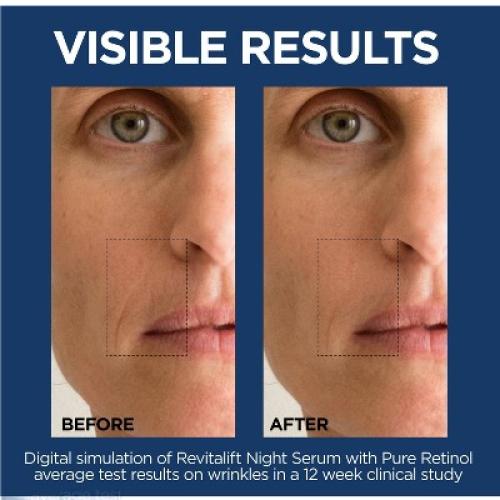 L'Oreal Paris Revitalift Derm Intensives Retinol Night Serum - 1 fl oz