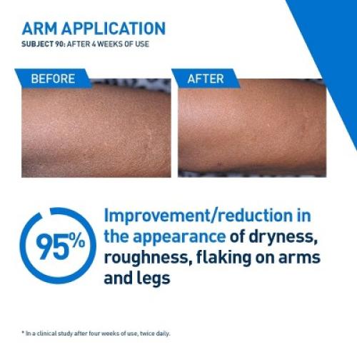 CeraVe Intensive Moisturizing Lotion For Dry to Very Dry Skin - 16 fl oz