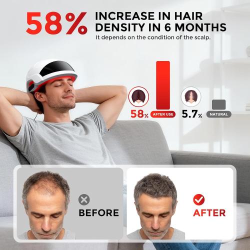 Hair Growth Device Red Light Therapy for Hair Growth Laser Cap FDA Cleared Laser Therapy Device - Promotes Hair Regrowth Alopecia Treatment for Men & Women