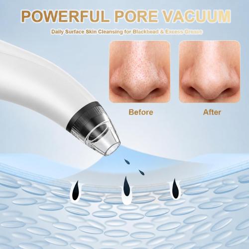 Blackhead Remover Tools,Electric Vacuum Facial Pore Cleaner Tool(White)