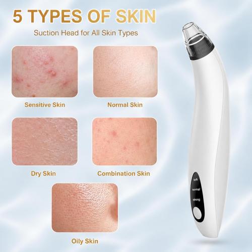 Blackhead Remover Tools,Electric Vacuum Facial Pore Cleaner Tool(White)