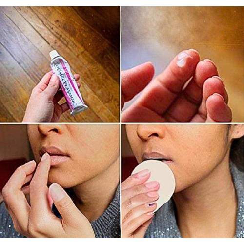Homeoplasmine, XL - 40g Magic Cream - For Dry Skin, Irritations, for Soft Lips! [ The Original French Packaging ]