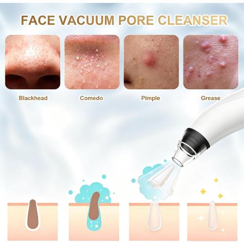 Blackhead Remover Tools,Electric Vacuum Facial Pore Cleaner Tool(White)