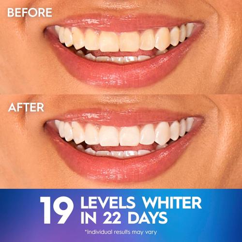 Crest Teeth Whitening Strips, Crest 3D Whitestrips Professional Effects, Enamel Safe Teeth Whitening Kit, 22 Treatments (44 Strips), Professional-Level Whitening, 19 Levels Whiter