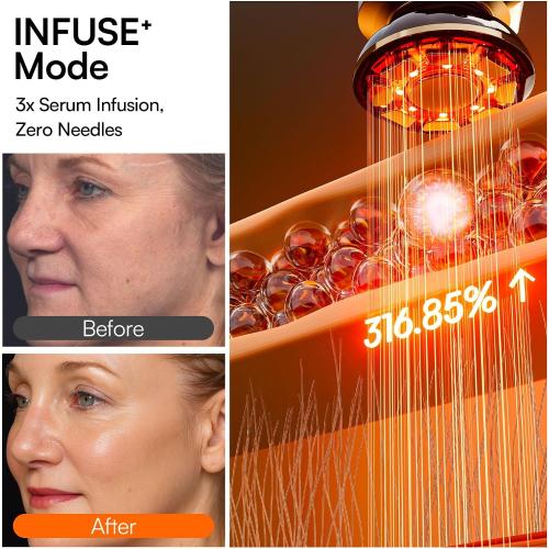 INIA FLARE 3-in-1 Microcurrent Facial Device Red Light Therapy for Face